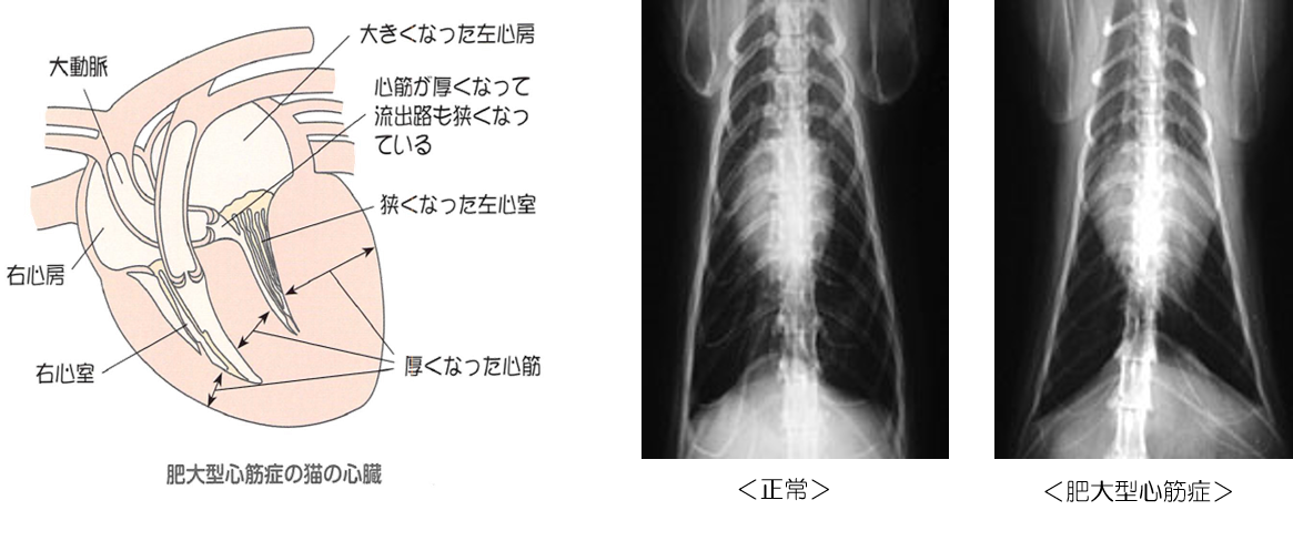 症例に学ぶ 肥大型心筋症 大型本（大型本） 心エコー解説 ～肥大型心筋症を診る～【第10回】症例紹介①